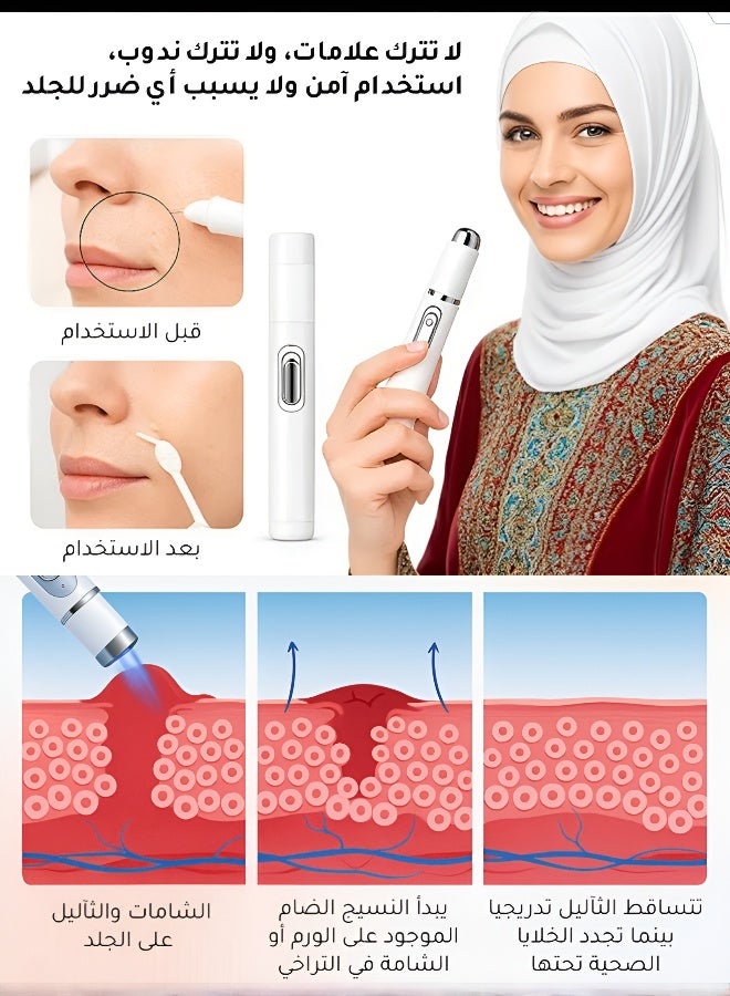 Xorita Non-Invasive Mole and Wart Removal Pen
