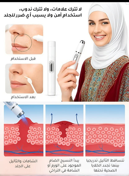Xorita Non-Invasive Mole and Wart Removal Pen